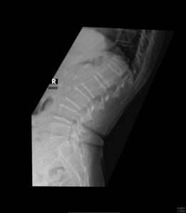X-rays of the spine